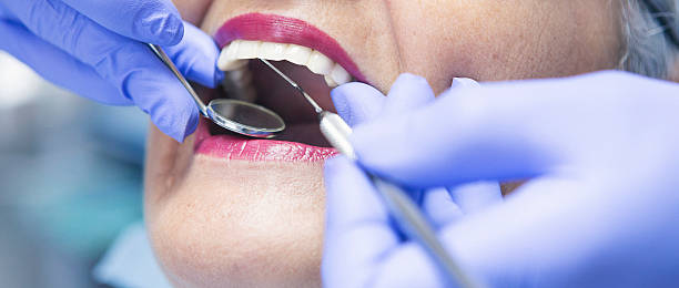 Best Emergency Dental Extractions in Mount Holly Springs, PA